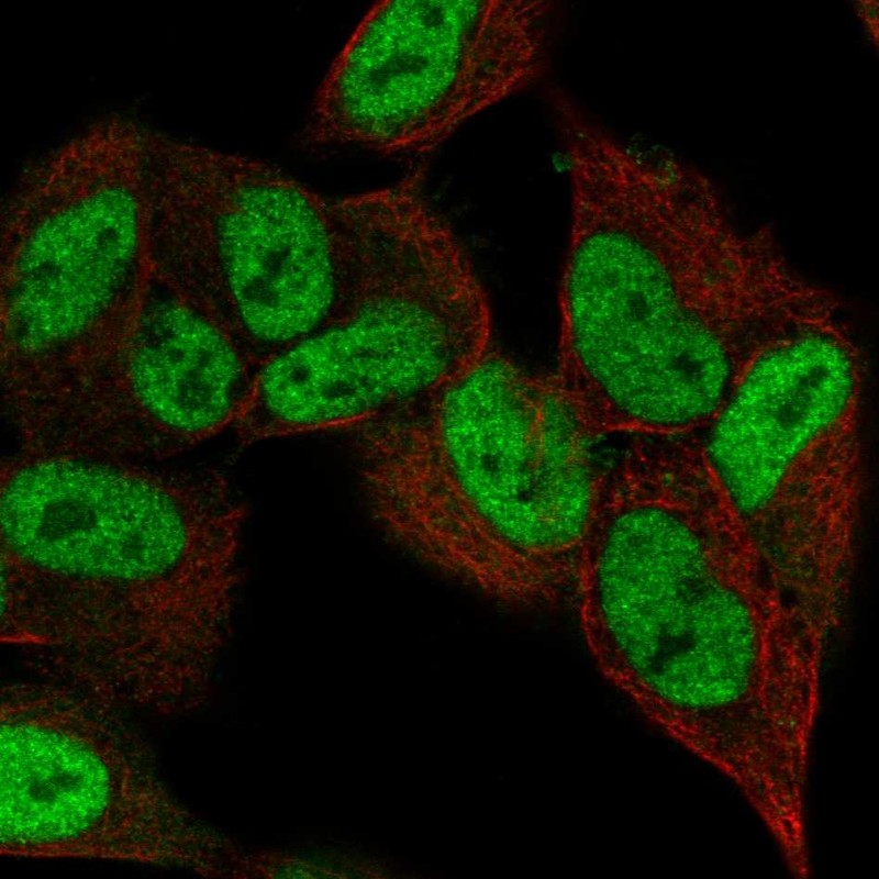 Anti-ZNF333 Antibody