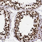 Immunohistochemical staining of human testis shows strong nuclear positivity in cells in seminiferous ducts.
