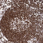 Immunohistochemical staining of humanlymph node shows strong nuclear positivity in lymphoid cells.