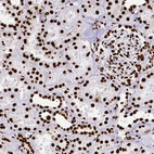 Immunohistochemical staining of human kidney shows strong nuclear positivity in cells in tubules.