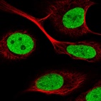 Immunofluorescent staining of human cell line U-2 OS shows localization to nucleoplasm.