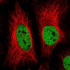 Immunofluorescent staining of human cell line HeLa shows localization to nucleoplasm.