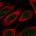 Anti-C8orf44 Antibody