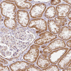Anti-NDUFAF2 Antibody