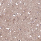 Immunohistochemical staining of human cerebral cortex shows high expression.