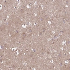 Immunohistochemical staining of human cerebral cortex shows high expression.