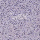 Anti-TLN2 Antibody