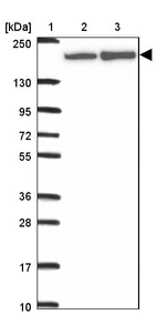 Lane 1: Marker [kDa] 250, 130, 95, 72, 55, 36, 28, 17, 10_br/_Lane 2: Human cell line RT-4_br/_Lane 3: Human cell line U-251MG sp