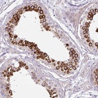 Anti-CFAP47 Antibody