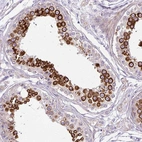 Anti-CFAP47 Antibody