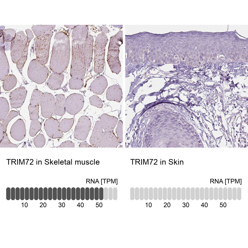 Anti-TRIM72 Antibody