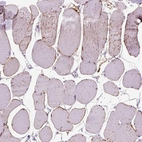 Immunohistochemical staining of human skeletal muscle shows high expression.
