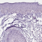 Immunohistochemical staining of human skin shows low expression as expected.