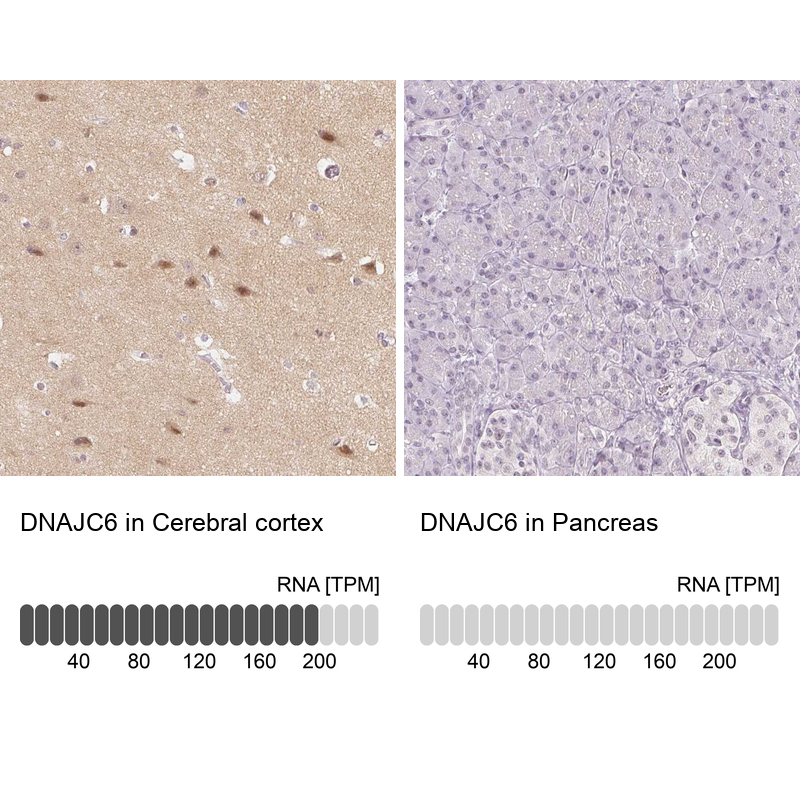 Anti-DNAJC6 Antibody