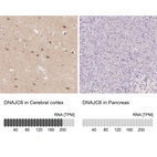 Anti-DNAJC6 Antibody