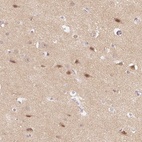 Immunohistochemical staining of human cerebral cortex shows high expression.