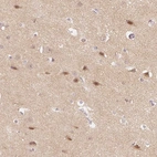 Immunohistochemical staining of human cerebral cortex shows high expression.