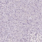 Anti-DNAJC6 Antibody