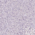 Immunohistochemical staining of human pancreas shows low expression as expected.