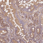 Immunohistochemical staining of human small intestine moderate cytoplasmic granular positivity in glandular cells and lymphoid cells.