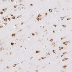 Immunohistochemical staining of human cerebral cortex shows strong cytoplasmic granular positivity in neurons.