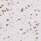 Immunohistochemical staining of human cerebral cortex shows strong cytoplasmic granular positivity in neurons.