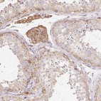 Immunohistochemical staining of human testis shows moderate cytoplasmic granular positivity in leydig cells and cells in seminiferous duct cells.
