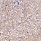 Anti-CMTM8 Antibody