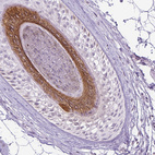 Anti-KRT27 Antibody