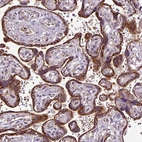 Anti-MSMP Antibody