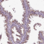 Immunohistochemical staining of human prostate shows strong cytoplasmic granular positivity in glandular cells.