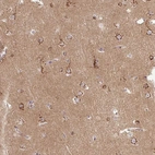 Immunohistochemical staining of human cerebral cortex shows strong cytoplasmic granular positivity in neurons.