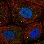 Immunofluorescent staining of human cell line MCF7 shows localization to nucleoplasm & vesicles.