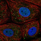 Immunofluorescent staining of human cell line MCF7 shows localization to nucleoplasm & vesicles.