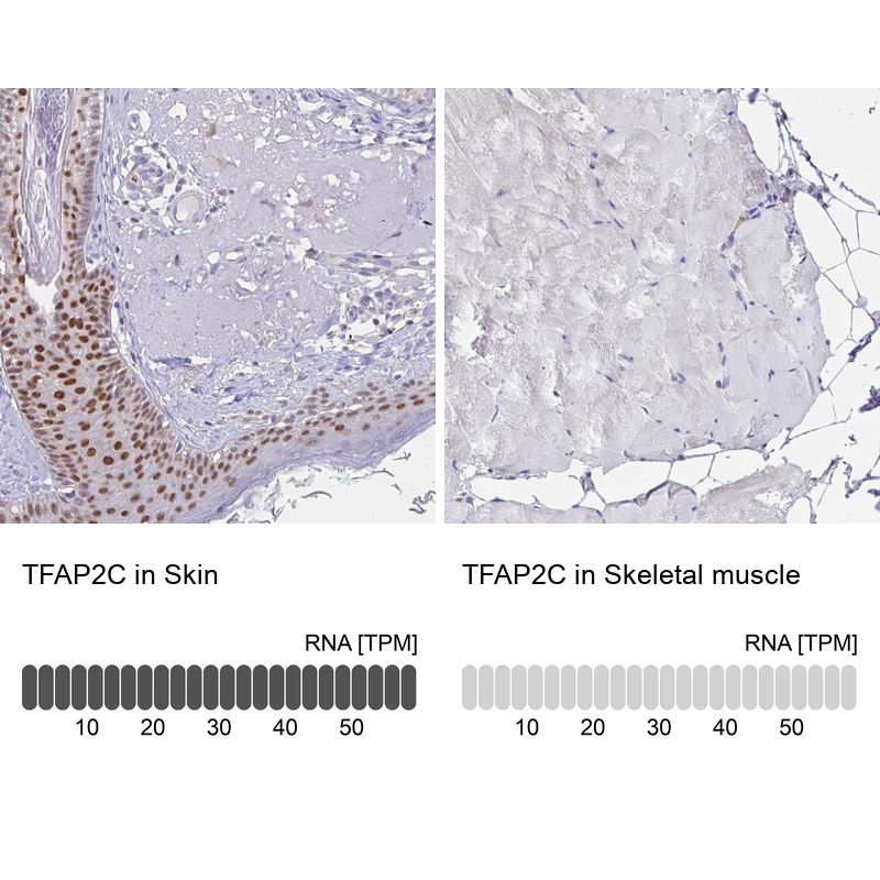 Anti-TFAP2C Antibody