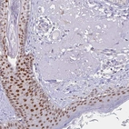 Immunohistochemical staining of human skin shows high expression.