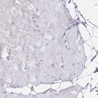 Immunohistochemical staining of human skeletal muscle shows low expression as expected.