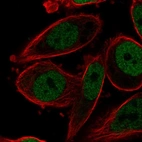 Immunofluorescent staining of human cell line PC-3 shows localization to nucleoplasm.