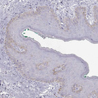 Immunohistochemical staining of human Skin shows weak cytoplasmic positivity in keratinocytes.