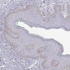 Immunohistochemical staining of human Skin shows weak cytoplasmic positivity in keratinocytes.