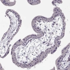 Immunohistochemical staining of human Placenta shows no cytoplasmic positivity in trophoblastic cells as expected.