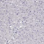 Immunohistochemical staining of human Liver shows no cytoplasmic positivity in hepatocytes as expected.