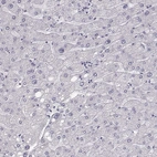 Immunohistochemical staining of human Liver shows no cytoplasmic positivity in hepatocytes as expected.