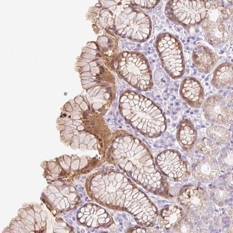 Anti-SLC25A40 Antibody