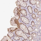 Anti-SLC25A40 Antibody