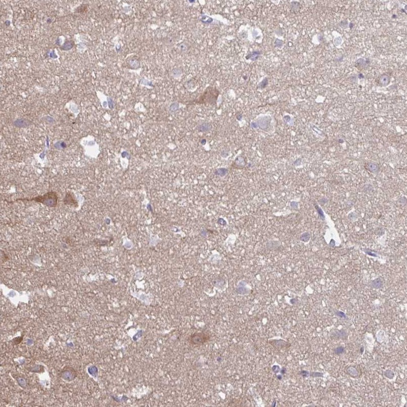 Anti-HYPK Antibody