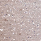 Anti-HYPK Antibody