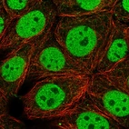Immunofluorescent staining of human cell line MCF7 shows localization to nucleoplasm & microtubules.