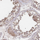 Immunohistochemical staining of human testis shows moderate to strong cytoplasmic positivity in cells in seminiferous ducts.