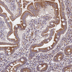 Anti-SAT1 Antibody